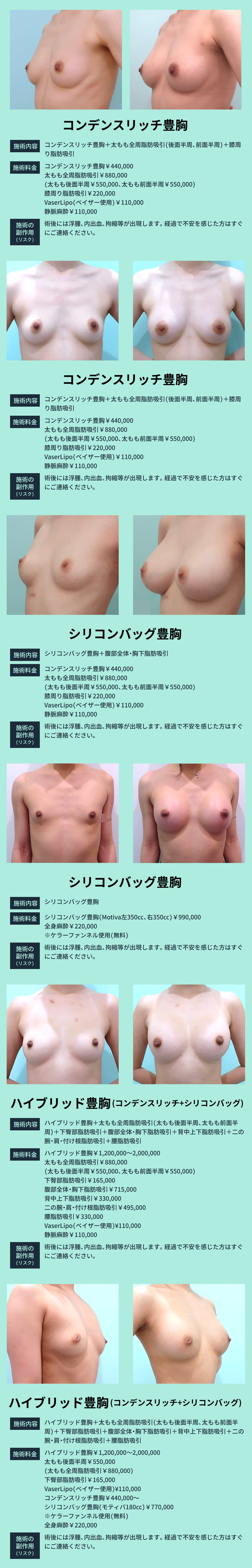 豊胸手術の種類と術前術後の比較画像