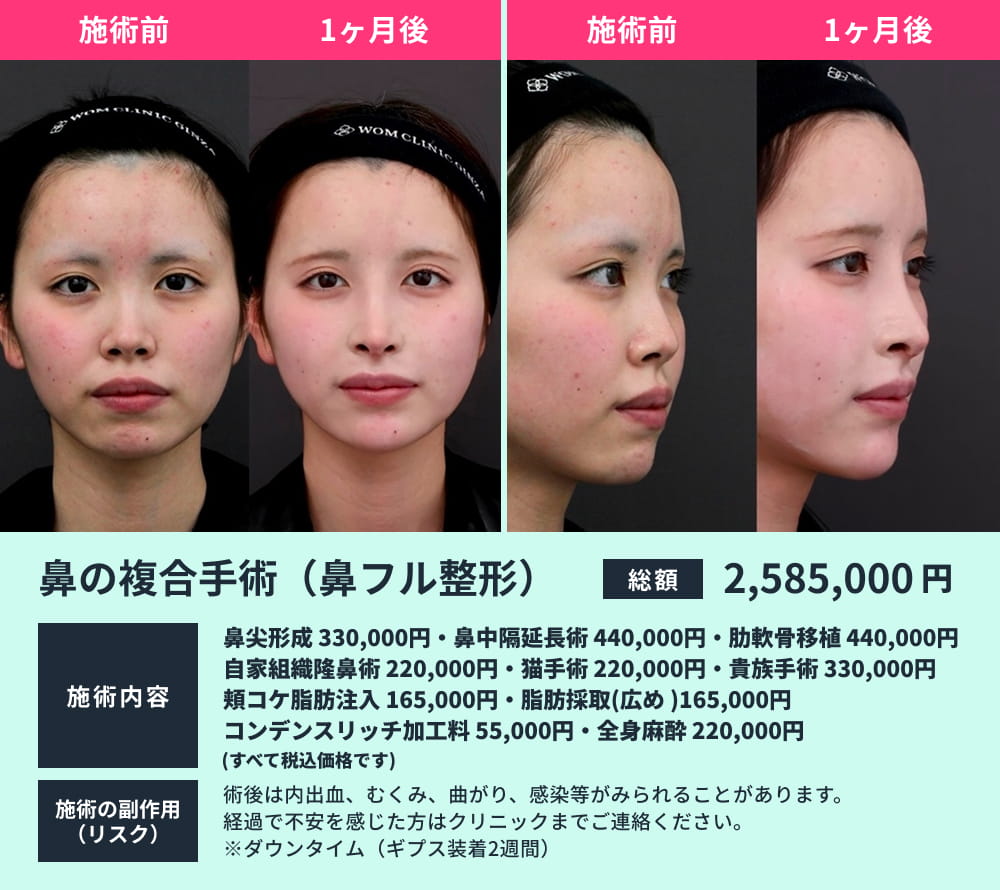 鼻整形名医】日本で選ばれる中井孝昌医師の症例と実績｜失敗しない医師