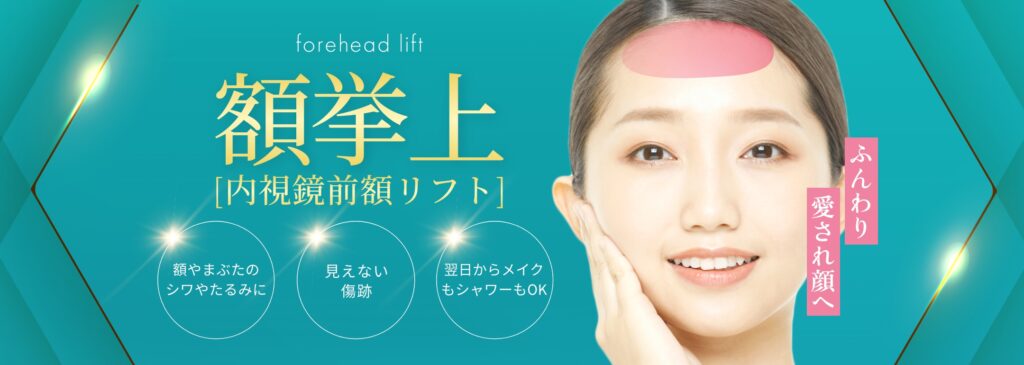 額拳上（内視鏡額挙上）