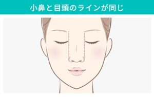 小鼻と目頭のラインが同じ