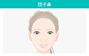 団子鼻