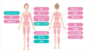 脂肪吸引の施術部位