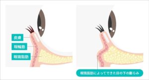 眼輪筋