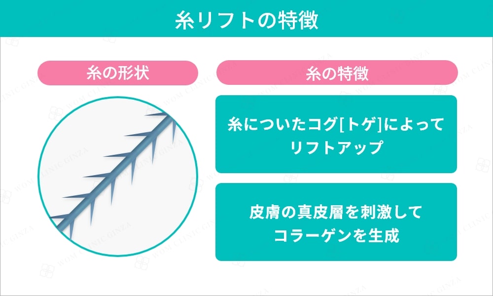 糸リフトの特徴