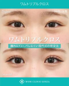 ワムトリプルクロスの症例写真