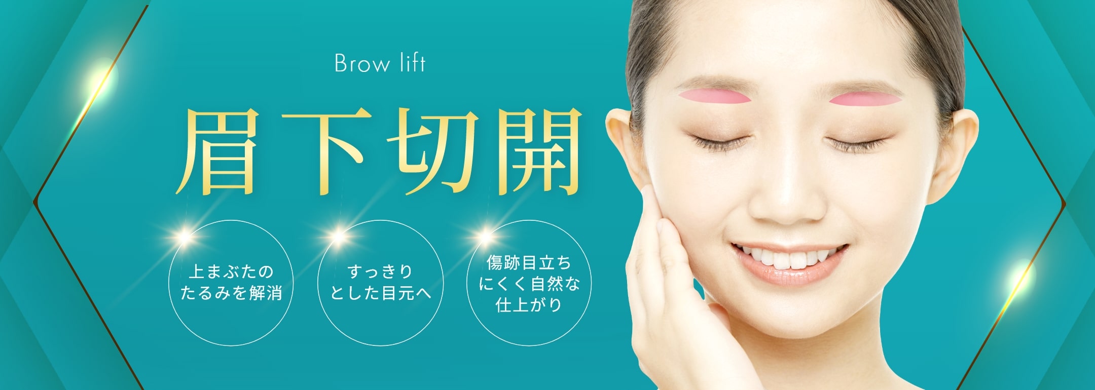眉下切開
