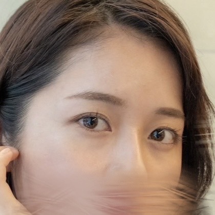 爆美女クマ整形 BEFORE写真