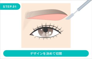 眉下切開の施術方法　STEP.1
