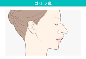ゴリラ鼻