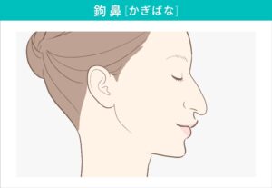 鉤鼻