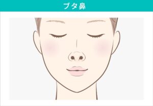 ブタ鼻