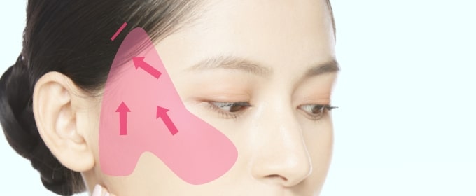ポニーテールリフト