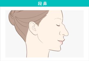 段鼻