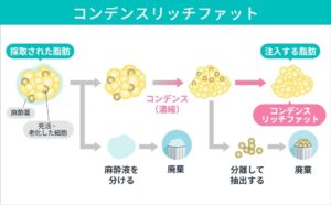 コンデンスリッチファット