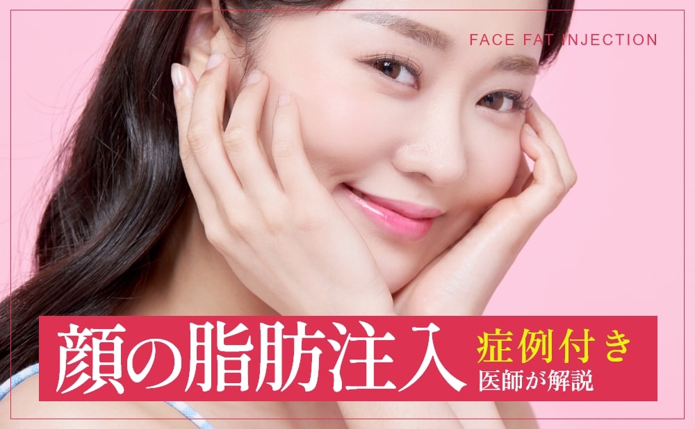 脂肪注入とは？顔の脂肪注入でおすすめな部位や症例を解説