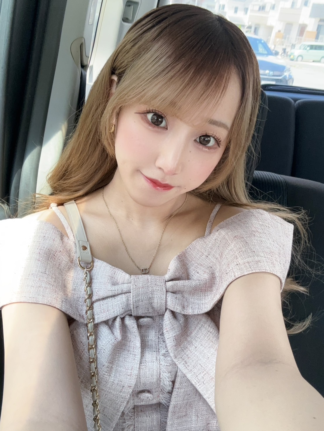 ACRが整った理想の忘れ鼻へ AFTER写真