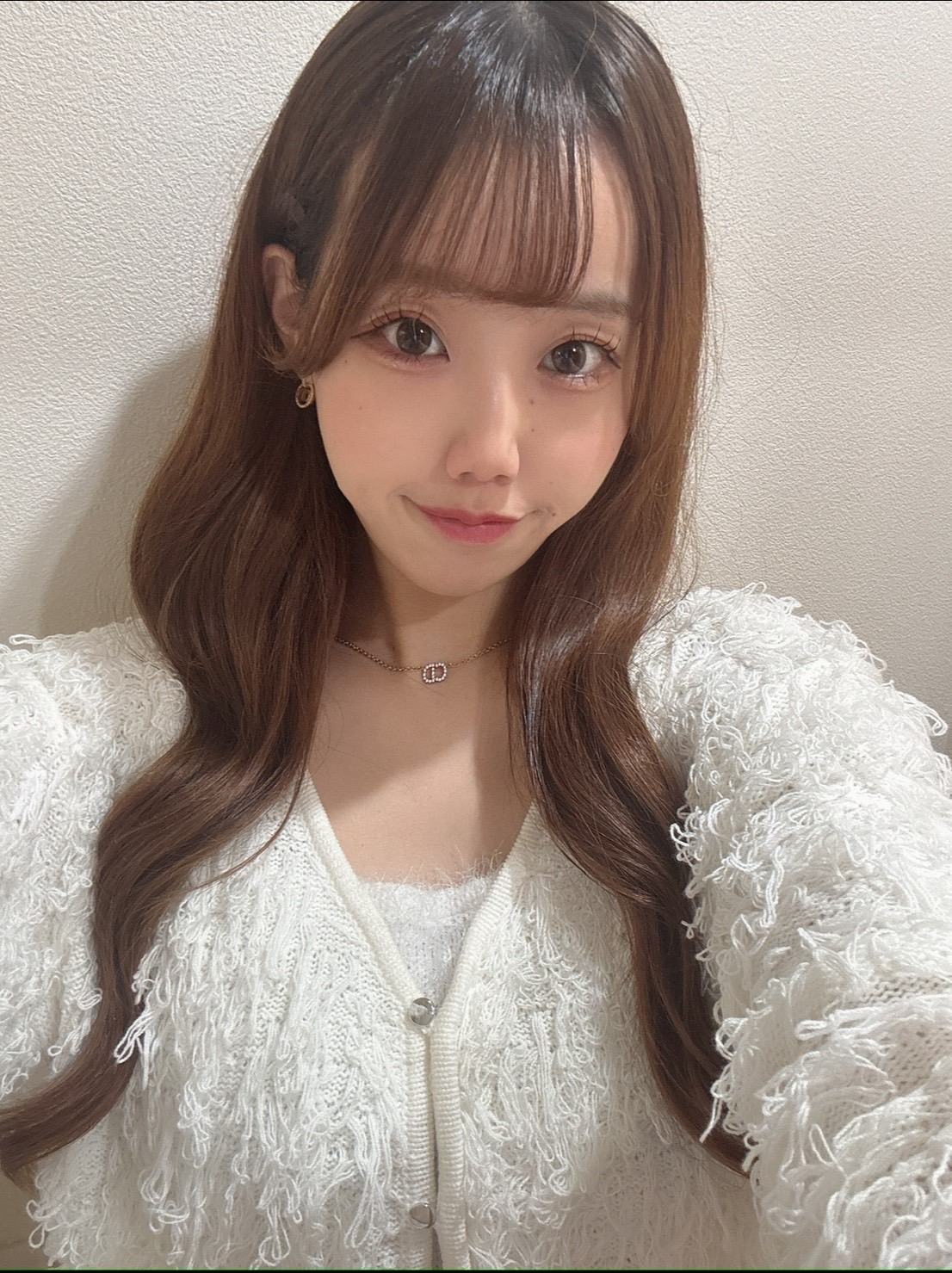 ACRが整った理想の忘れ鼻へ BEFORE写真