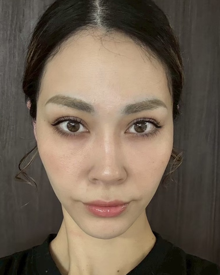 裏ハムラ AFTER写真