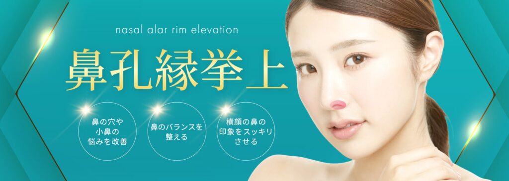 鼻孔縁挙上