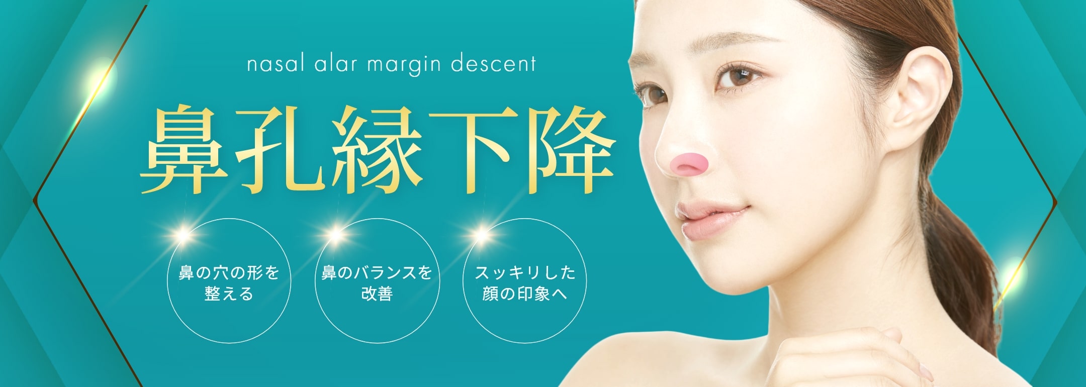鼻孔縁下降