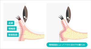 眼輪筋の位置