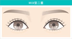 MIX型二重