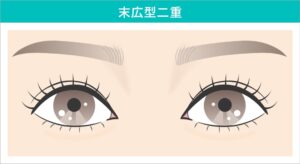 末広型二重