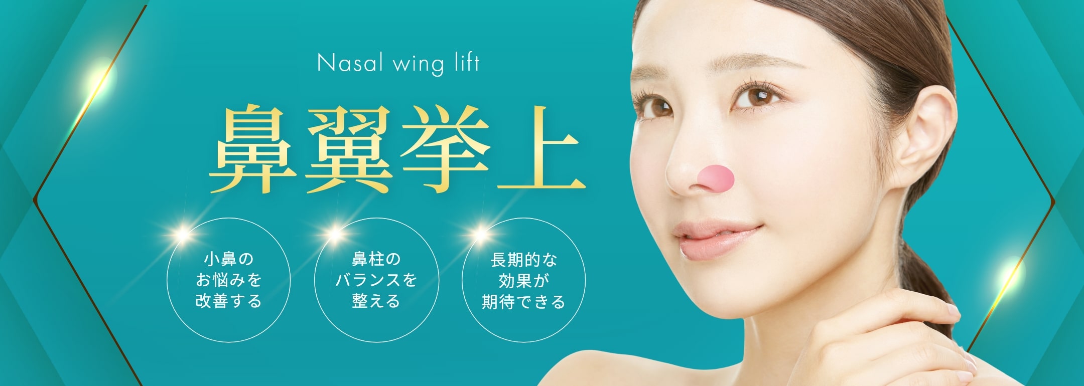 鼻翼挙上