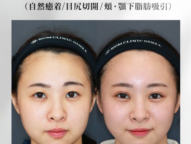 19209モリタホノカ