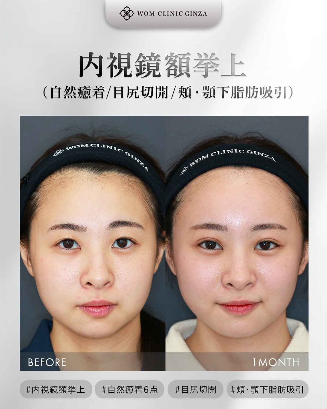 19209モリタホノカ