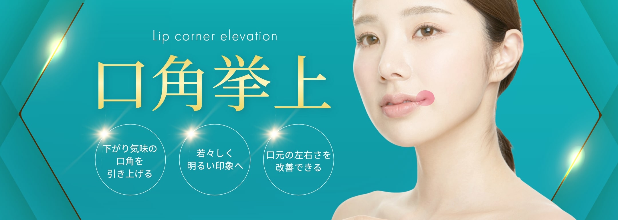 口角挙上