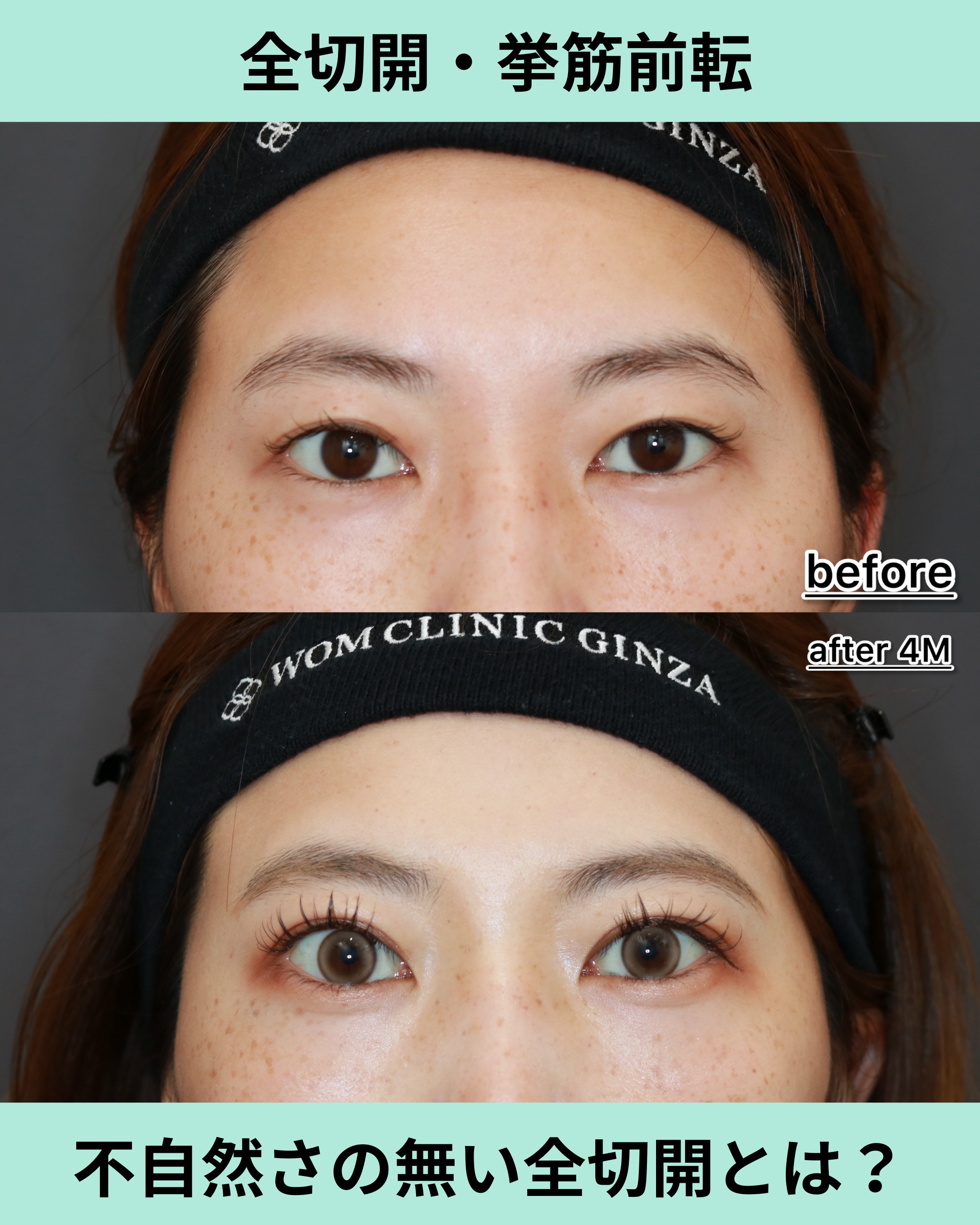 18624ハセガワルナ