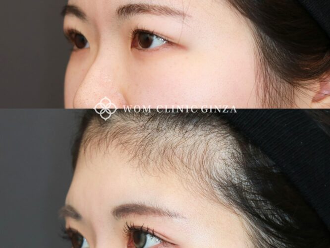 18882セイケアカリ