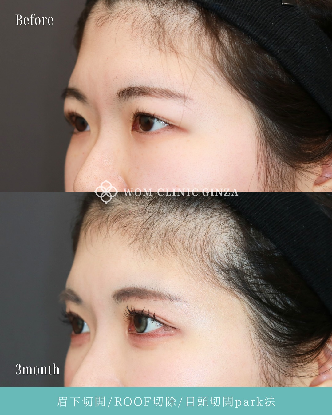 18882セイケアカリ