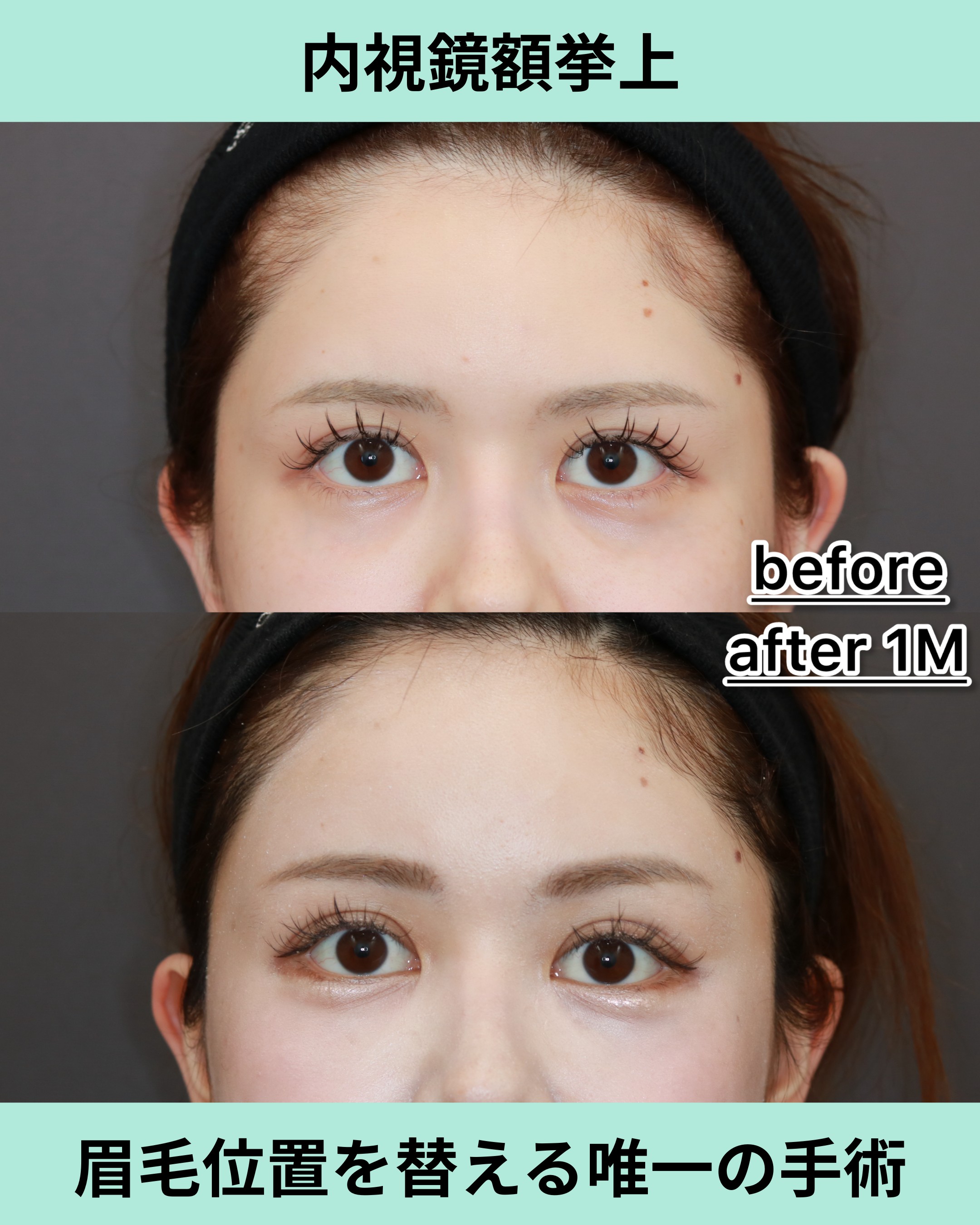 19273キシマユイナ