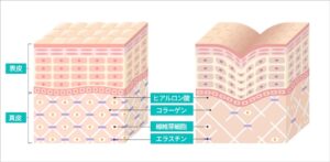 フェイスラインのたるみの原因