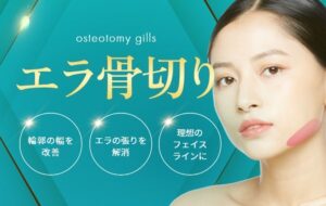 エラ骨切り