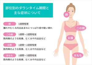 脂肪吸引のダウンタイム