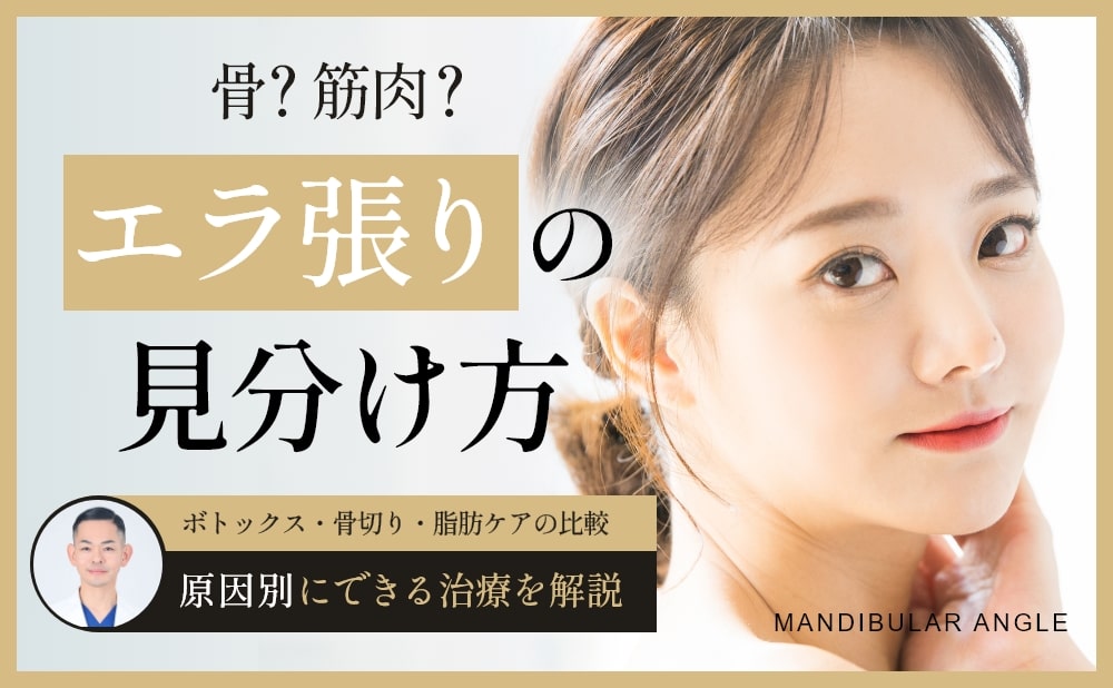 エラ張りは骨が原因？筋肉や脂肪との違いと治療法を専門医が解説