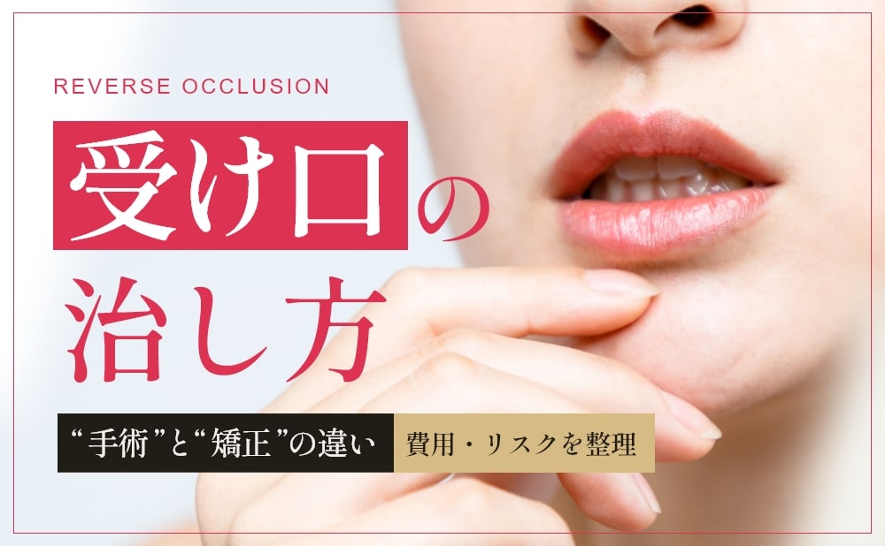 受け口は矯正だけで治る？両顎手術・セットバック・オトガイ形成の違い
