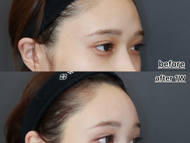 21527ヒガシオナオカ 1W