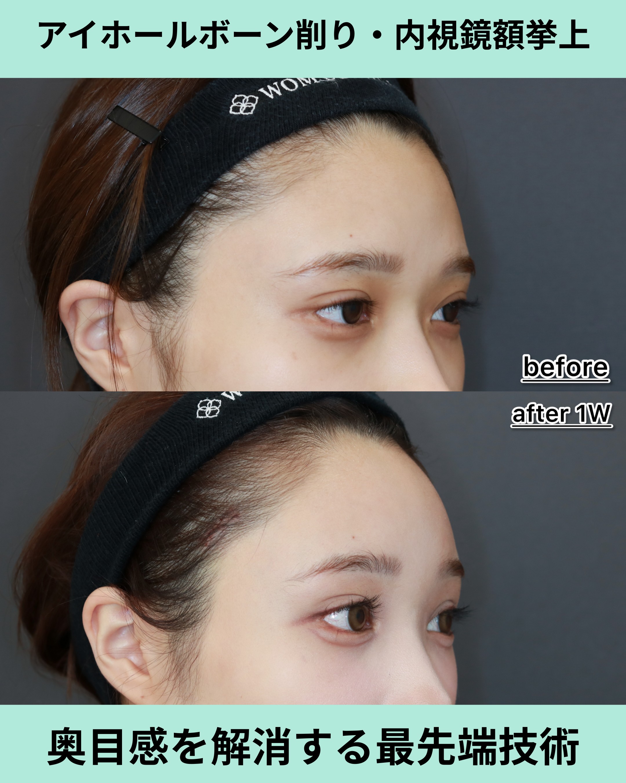 21527ヒガシオナオカ 1W