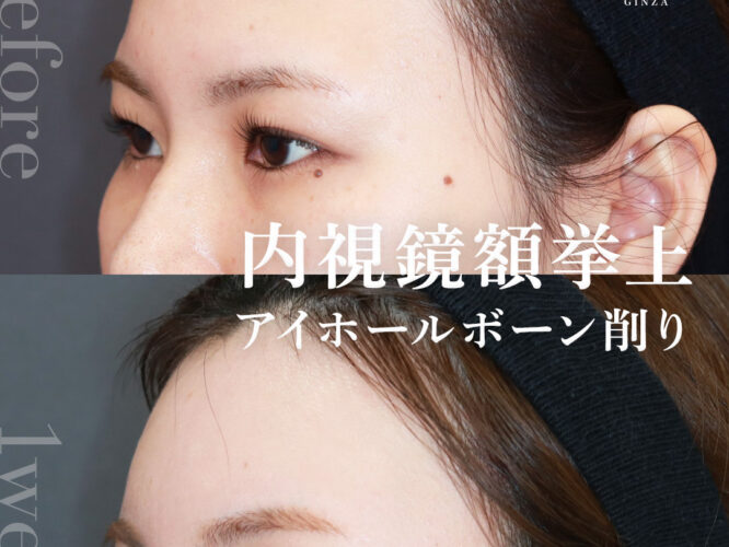 20191ムラカミアミ 1W