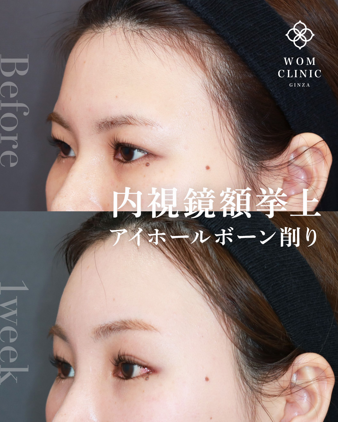 20191ムラカミアミ 1W