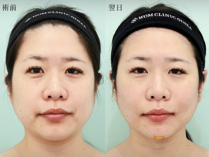 ヨネハラ サクラ 20897