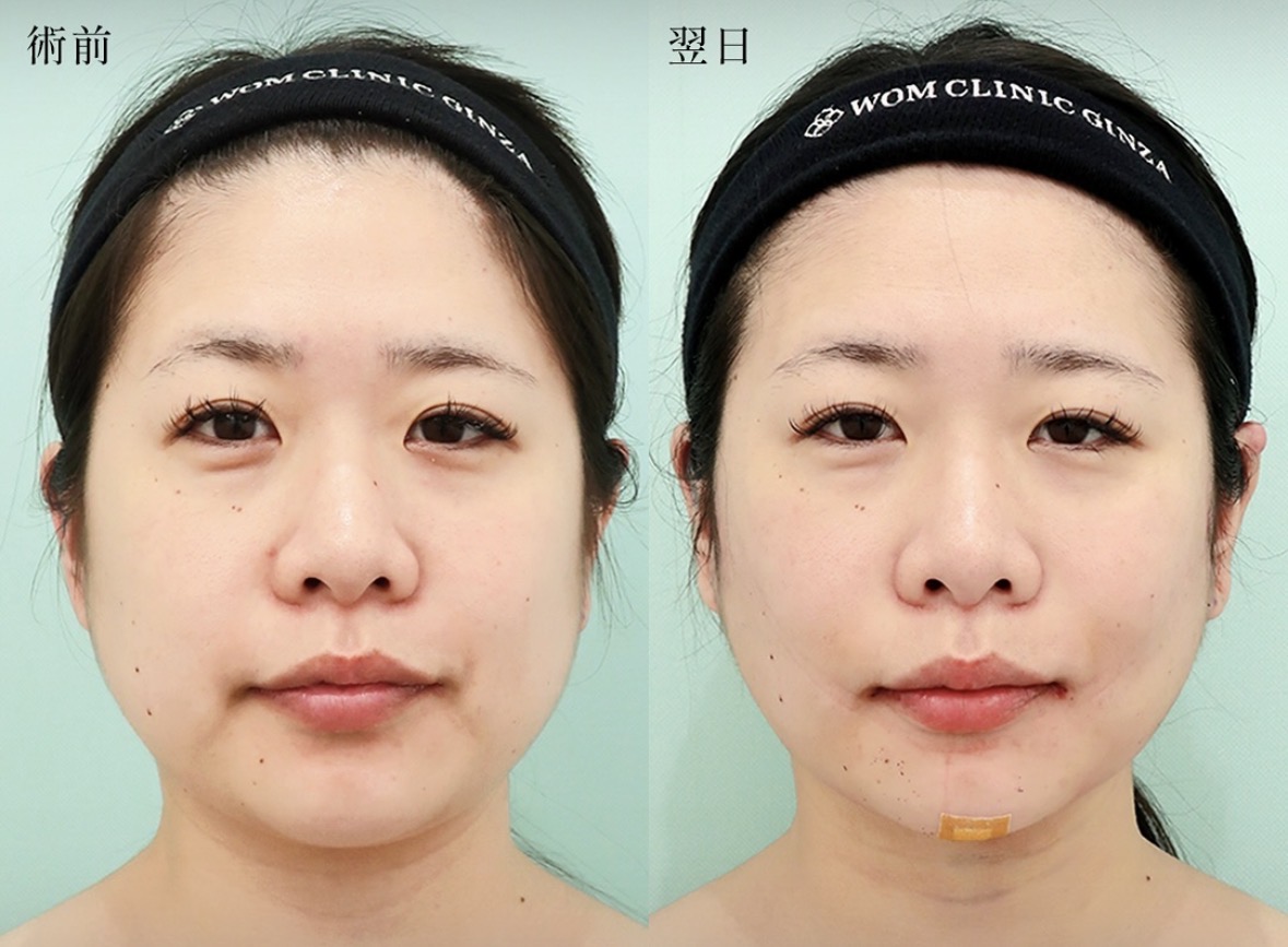 ヨネハラ サクラ 20897