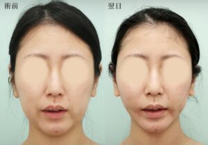 コバヤシ　アヤコ