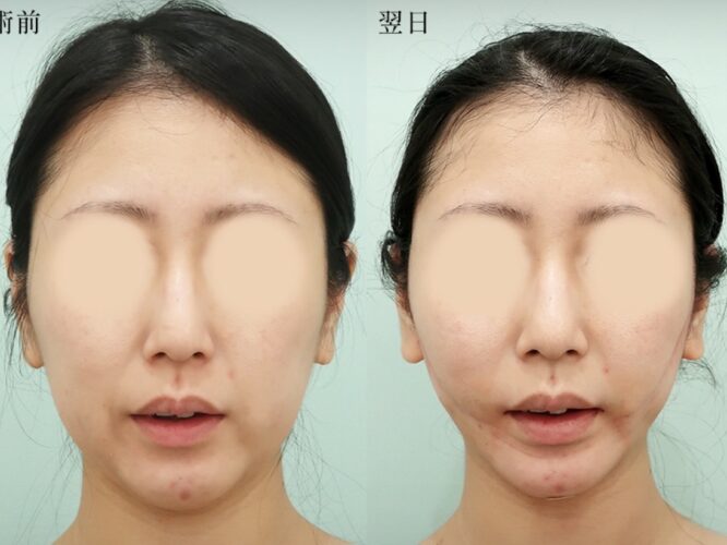 コバヤシ　アサコ