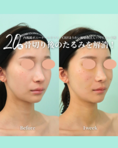 石川医師の症例写真01