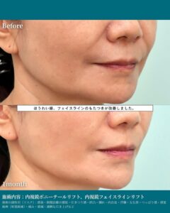 石川医師の症例写真02